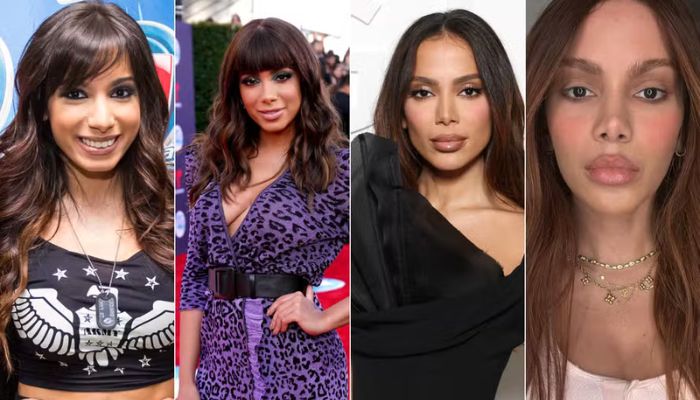 Foto: Getty Images e reprodução/Instagram Mudança radical de anitta acende debate: há limites para ‘comprar’ um novo rosto?